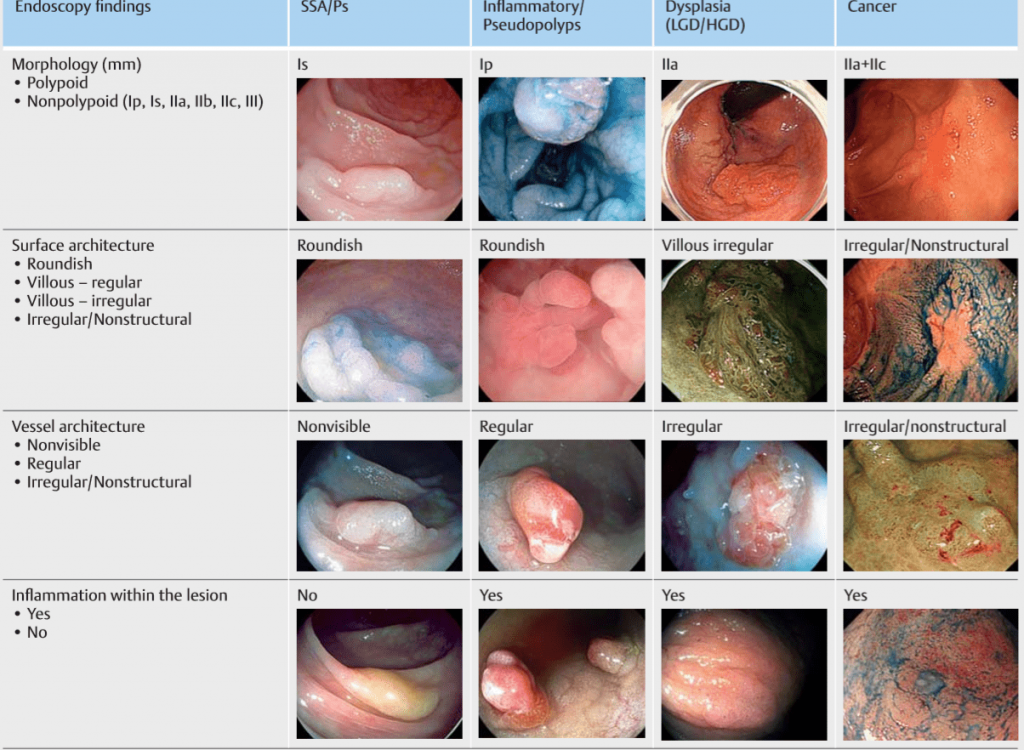 2020-05-02 05-31-42 Microsoft Edge — копия-min.png